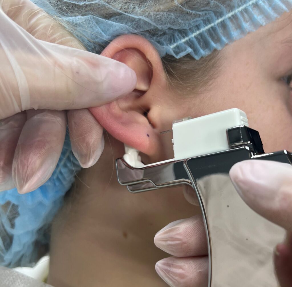 Exempel på öronhåltagning med diamantörhänge.